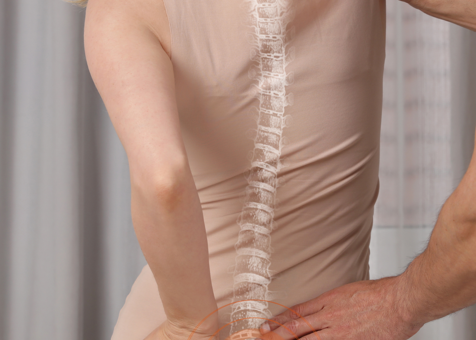 Scoliosis &amp; Spinal Deformity Correction